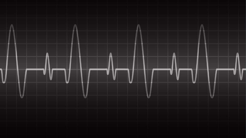 What is Heart Rate Controlled Training?